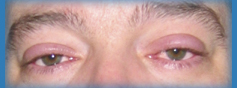 Augen am Tag der Diagnose f�rs WEB 2